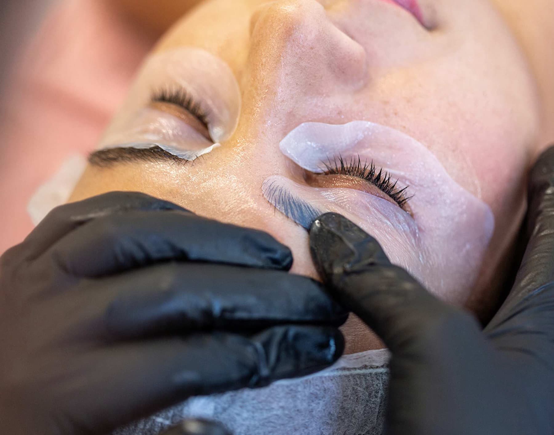 Eye Area Treatment