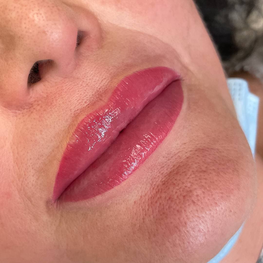 Labello Lips пред и потоа, прв пример, салон Медеја Ниш