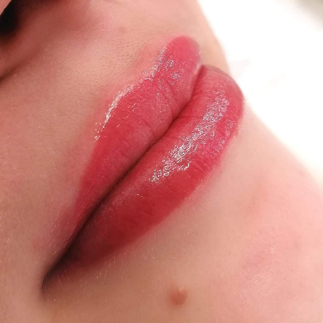 Permanent usana posle Medeja