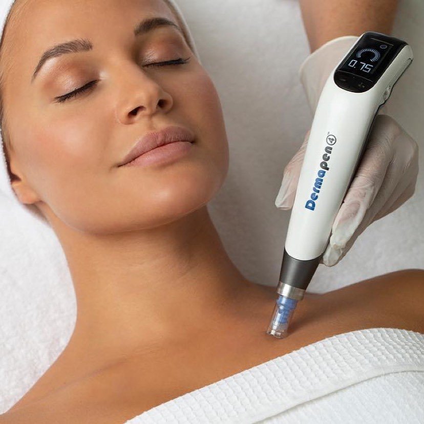 dermapen4